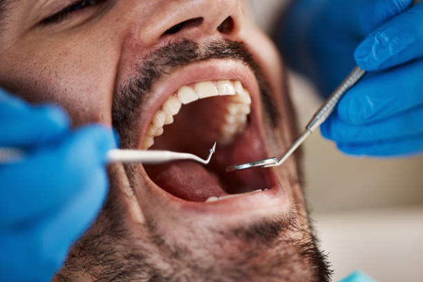 Best Emergency Dental Care for Abscessed Tooth in Deenwood, GA